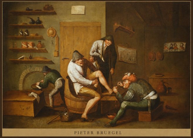 Pieter Bruegel The Foot Operation No5 - Plakát